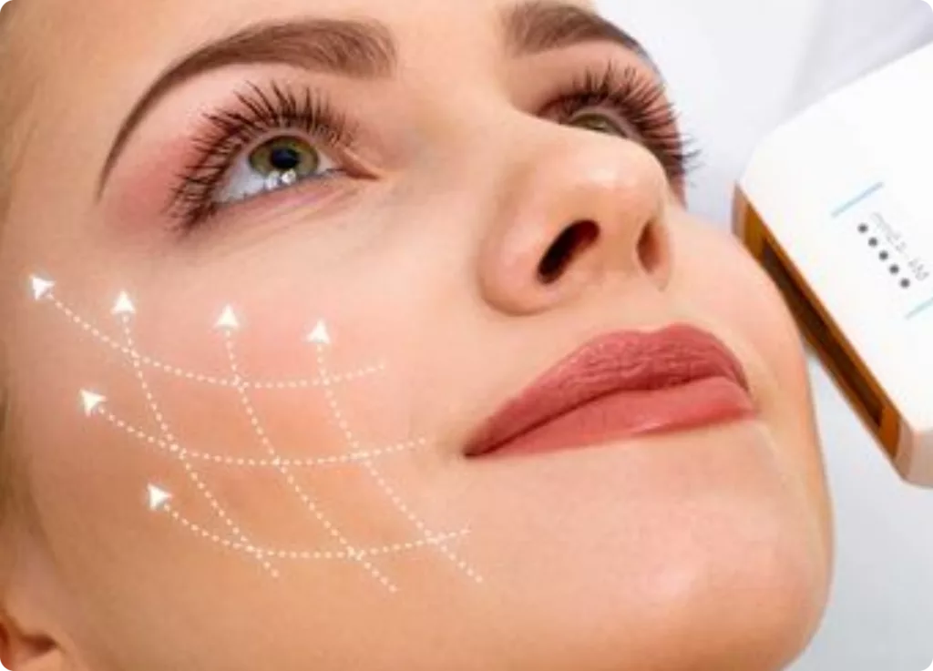 HIFU reafirmante facial no invasivo
