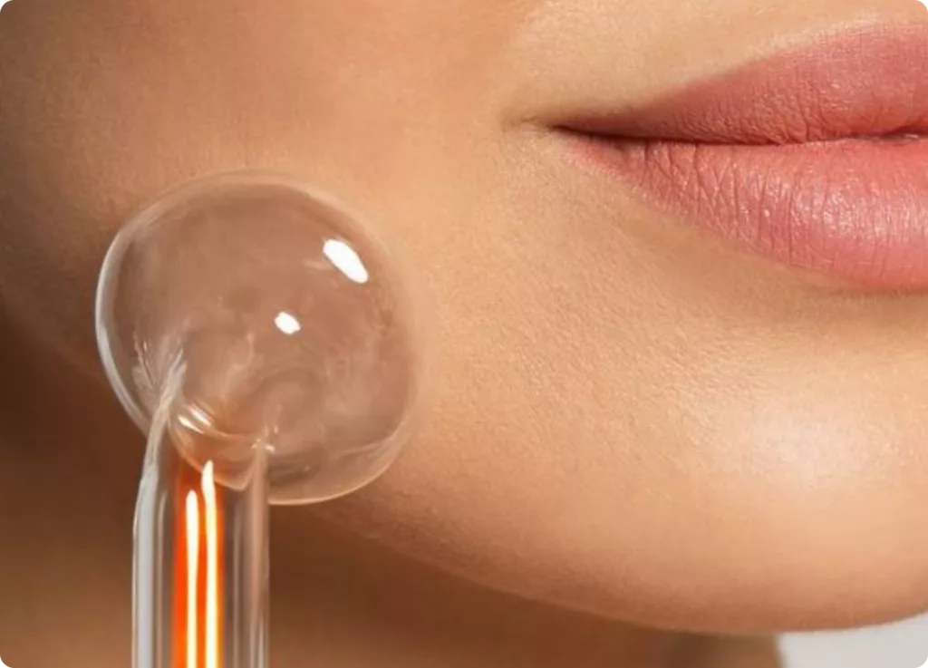 Limpieza facial profunda con microdermoabrasión en Aura Skin