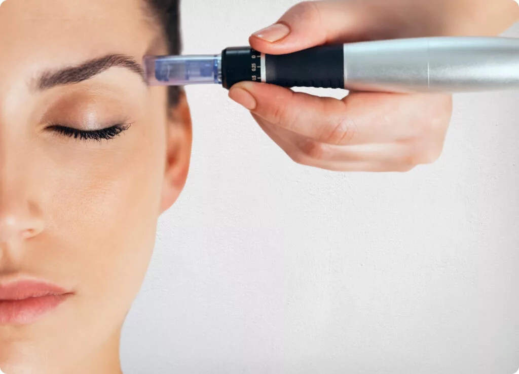 Tratamiento Dermapen para rejuvenecimiento facial