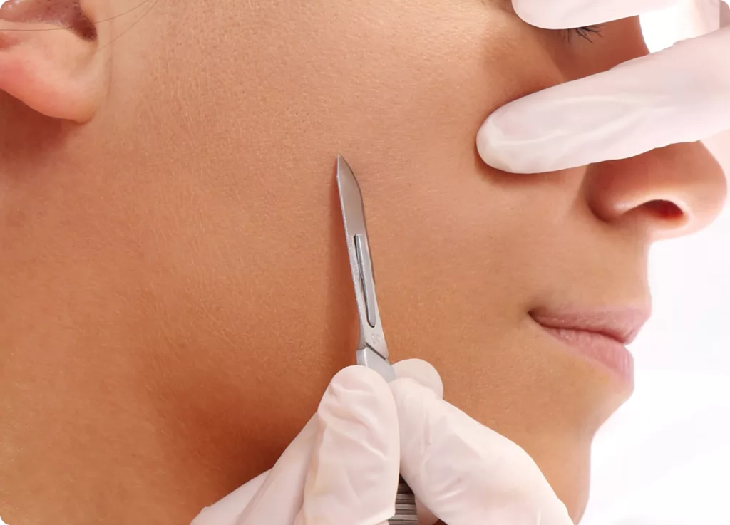 Dermaplaning exfoliación facial profesional