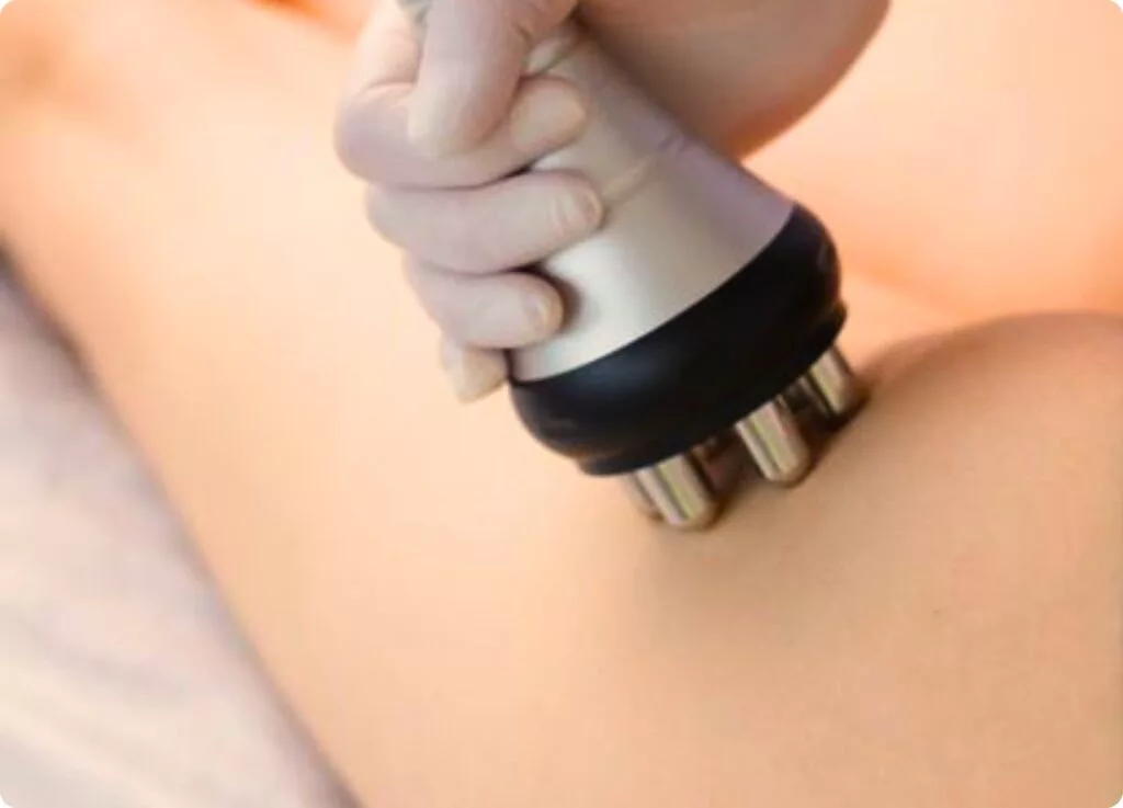 Radiofrecuencia corporal para colágeno y drenaje linfático