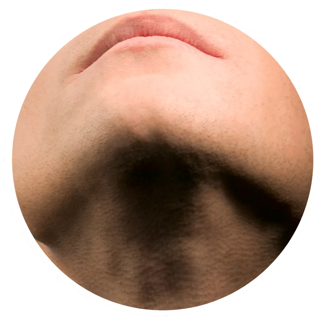 Depilación con cera barbilla hombre