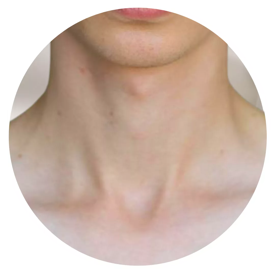 Depilación con cera cuello hombre