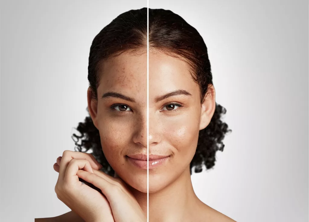 Tratamiento Dermo Technology Luxury Gold Aura Skin