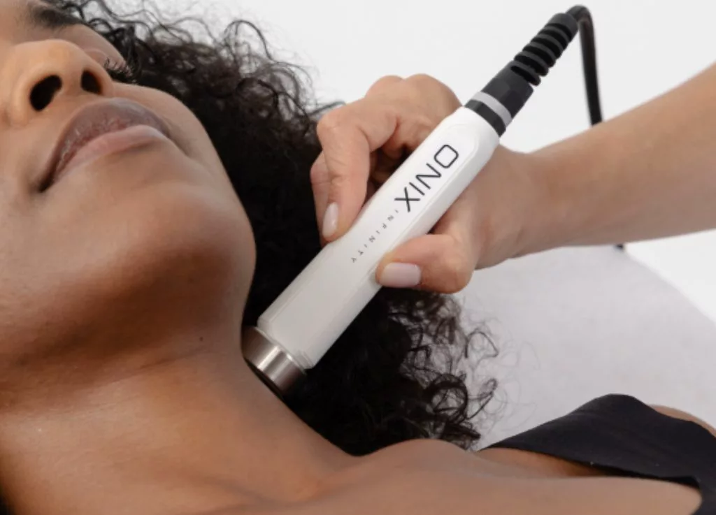 Radiofrecuencia Onix Infinity tratamiento facial